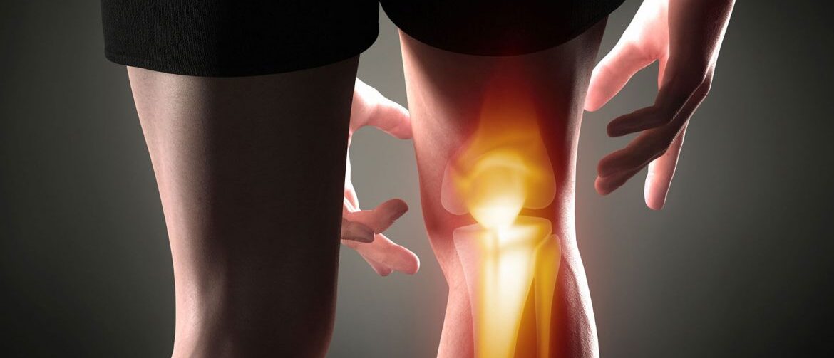 photo of a man with right knee bones highlighted to show painful area